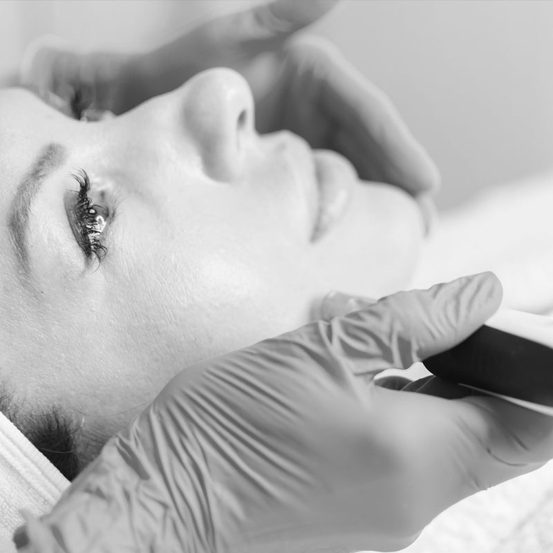 Microneedling